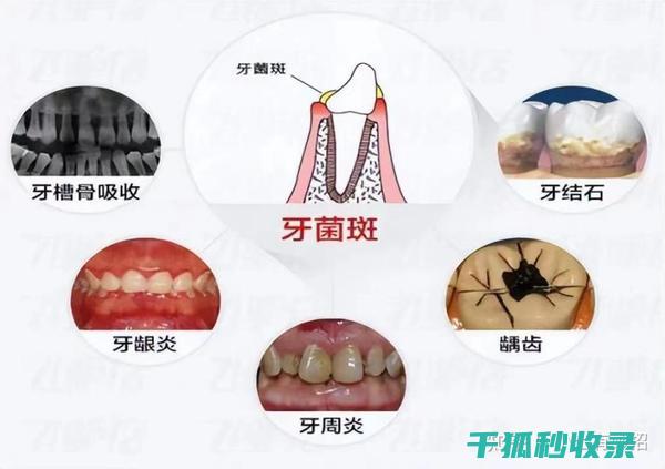 牙刷更换周期：从专业角度解读更换频率 (牙刷更换周期多久)